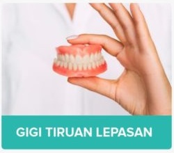Gigi Tiruan Lepasan Malang