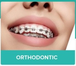 Orthodontic Behel Gigi Malang