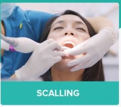 Scaling Karang Gigi Malang